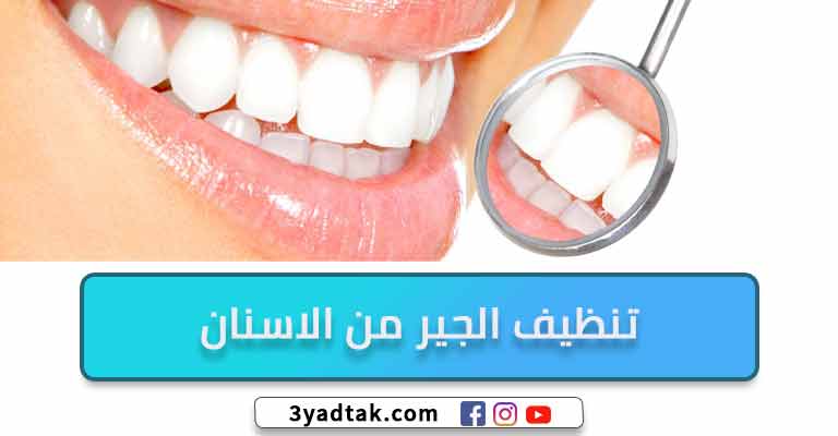فوائد تنظيف الجير من الاسنان
