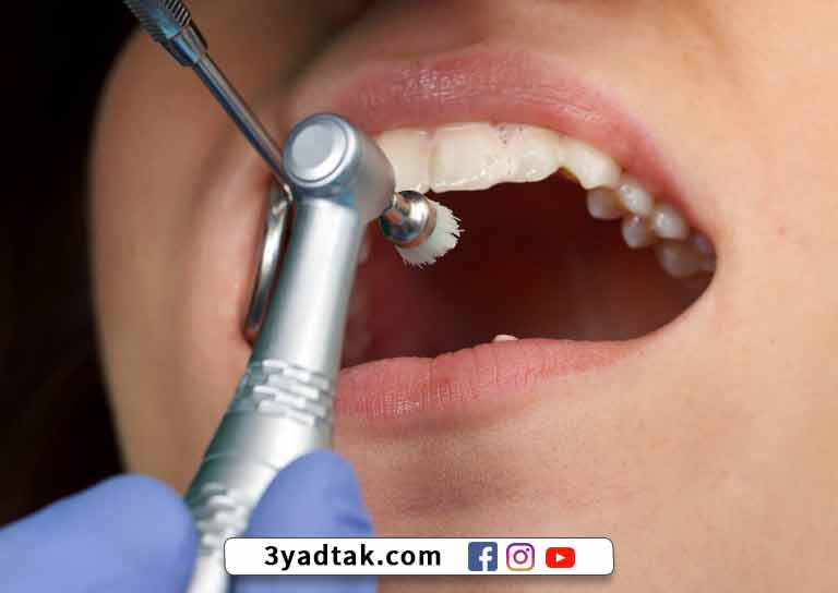 ما هي اضرار تنظيف الاسنان من الجير؟