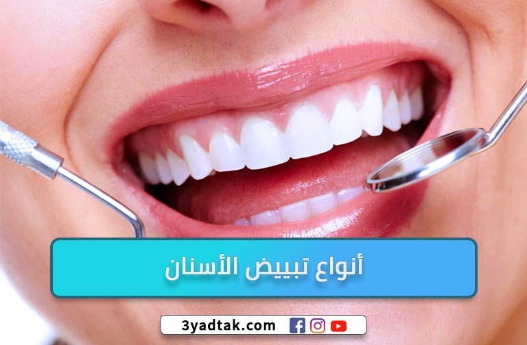 6 أنواع تبييض الأسنان وعيوب ومميزات تبييض الأسنان