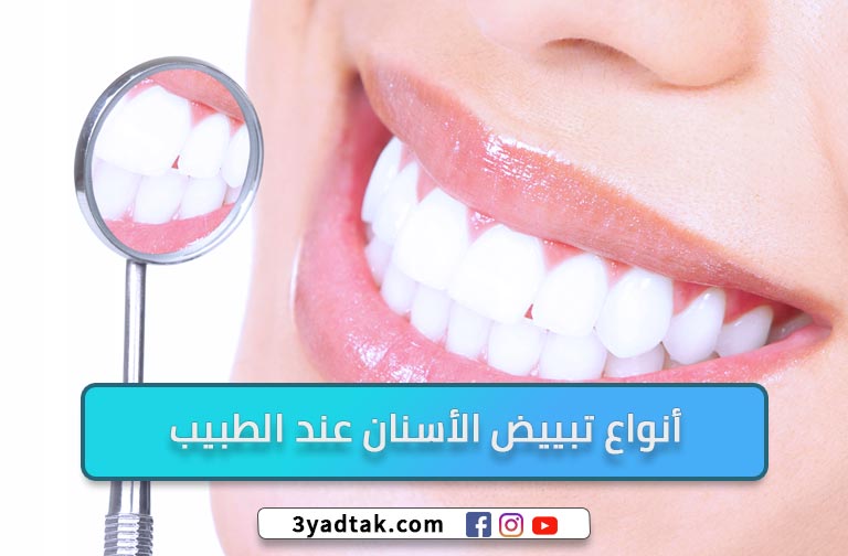 6 أنواع تبييض الأسنان وعيوب ومميزات تبييض الأسنان