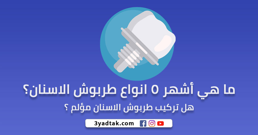 أشهر 5 انواع طربوش الاسنان واهم مميزاته وعيوبه و تكلفته