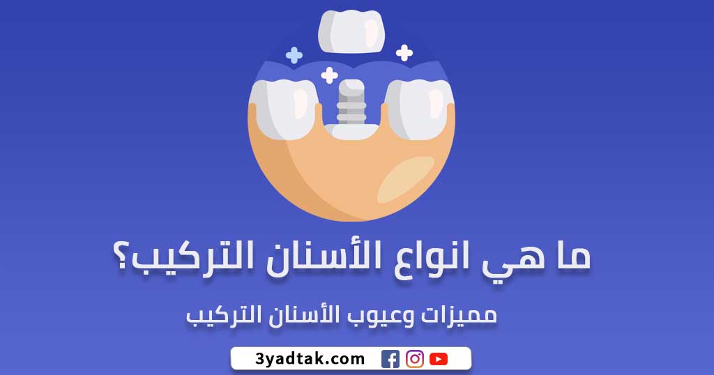 انواع الاسنان التركيب (الأسنان الثابتة، الأسنان المتحركة)