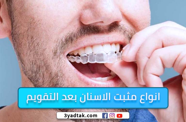 فراغات الاسنان بعد التقويم ومخاطرها وكيفية تجنبها ؟ 