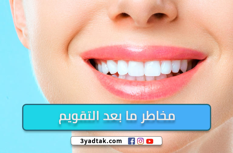 فراغات الاسنان بعد التقويم ومخاطرها وكيفية تجنبها ؟ 