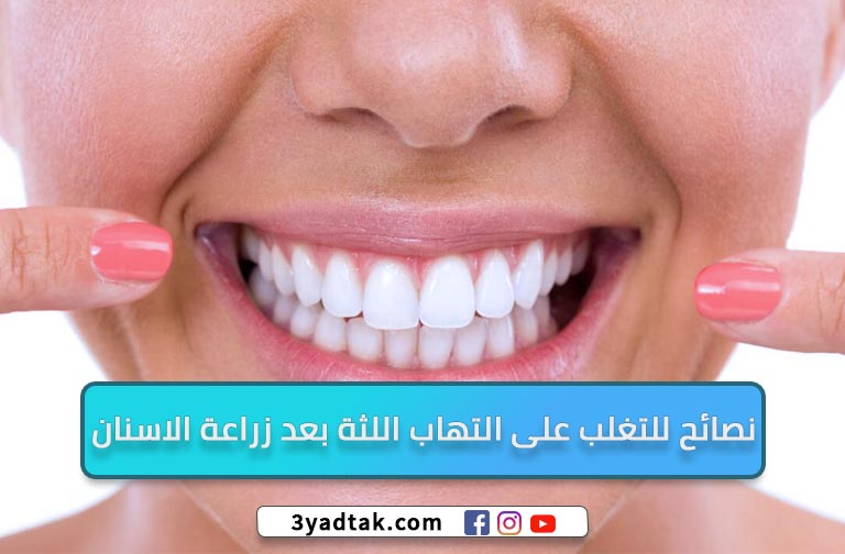 4 طُرق لعلاج التهاب اللثة بعد زراعة الاسنان وأسباب الإلتهاب