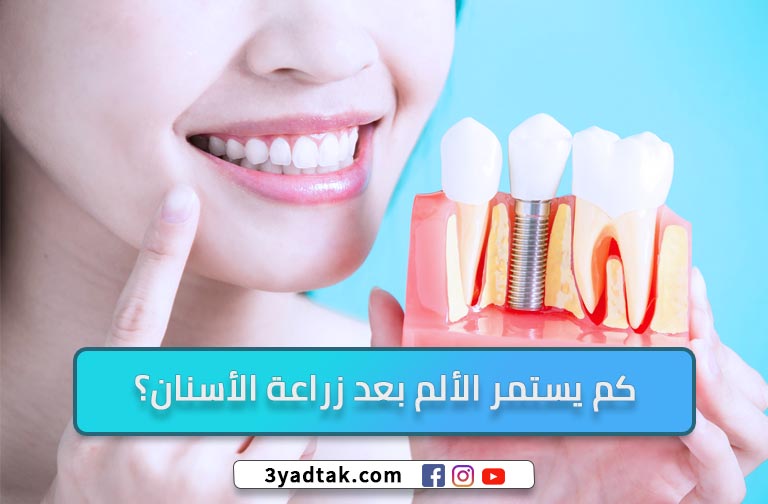 هل يوجد ألم بعد زراعة الأسنان؟ مميزات ومضاعفات زراعة الأسنان