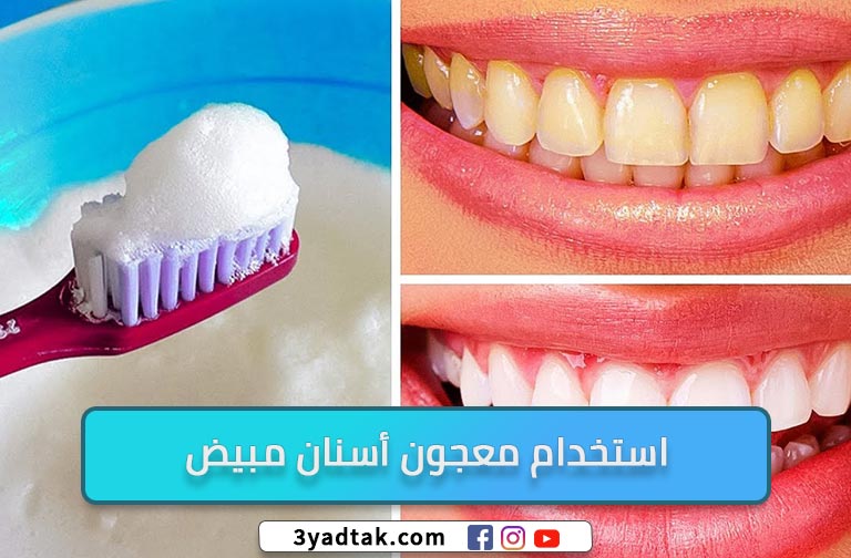 أهم 6 نصائح بعد تبييض الأسنان بالليزر | وهل التبيض باليزر له اضرار؟