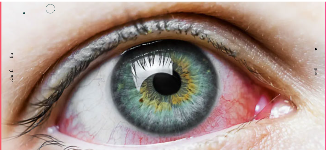 علاج نزيف شبكية العين