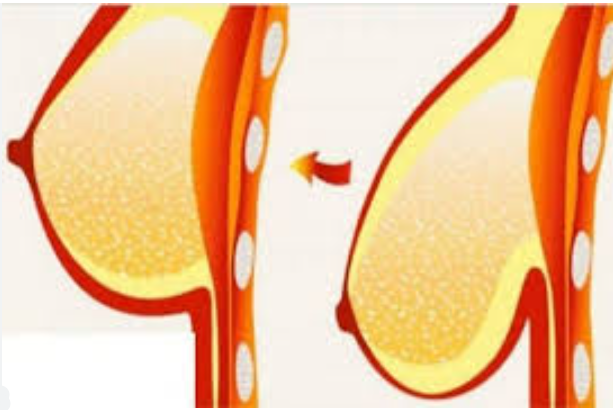 عمليات تجميل الثدي في مصر  ولماذا يعد الدكتور احمد صلاح أفضل دكتور تجميل في مصر؟